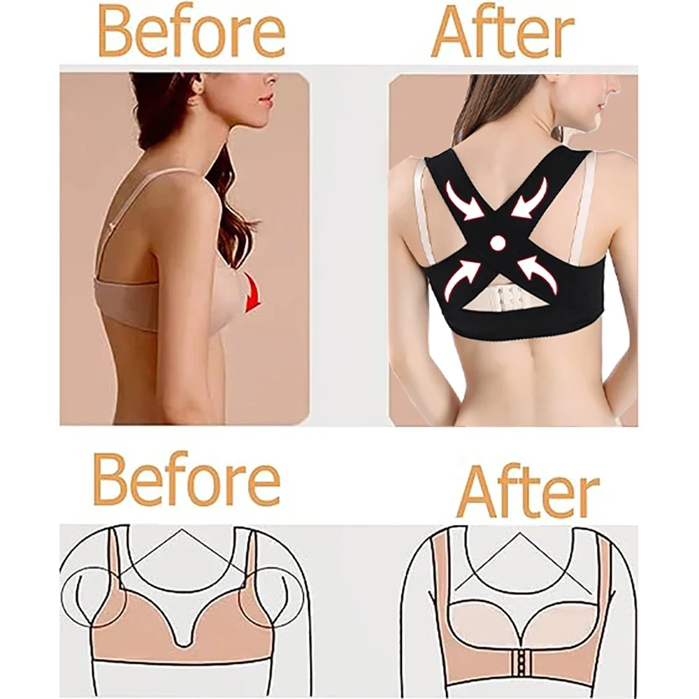 Posture Corrector for Women Ba – обзор и цена Posture Corrector Back